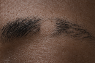 UNEVEN / PATCHY